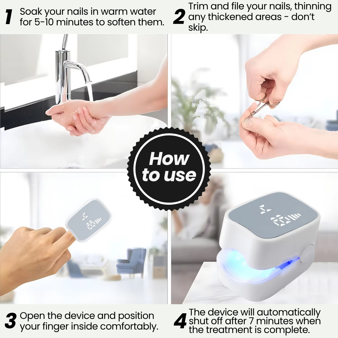 NailCure Pro™ - At-Home Nail Fungus Laser Device